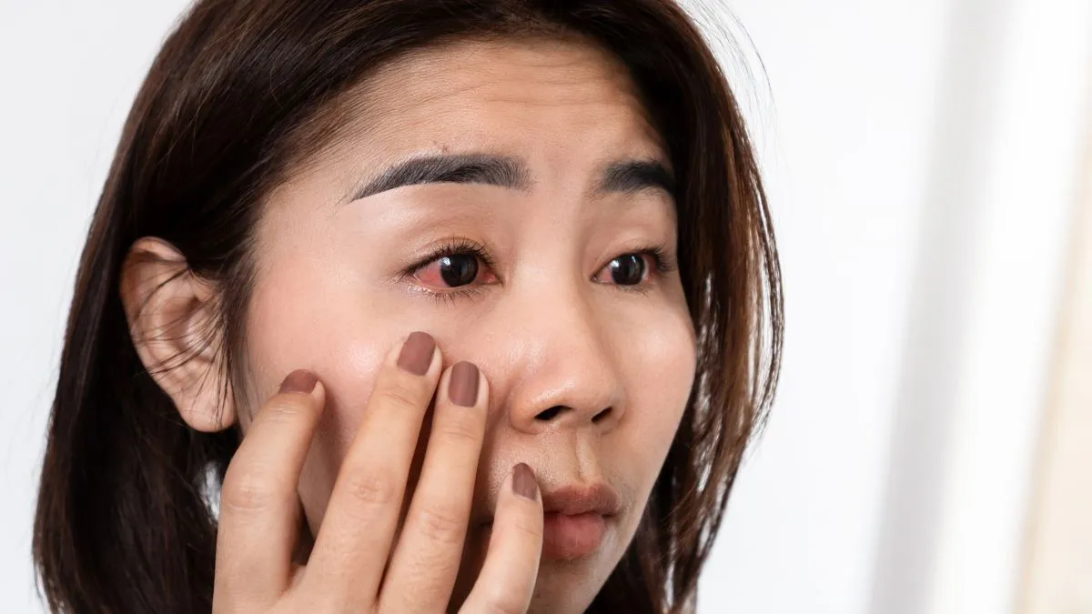 red-eyes-in-rain-how-monsoon-triggers-eye-infections-and-what-to-do-doctor-insights