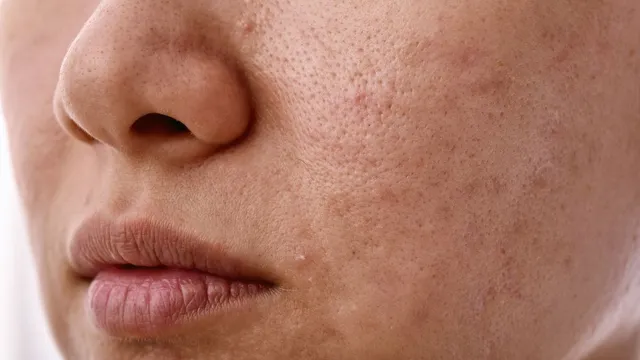 is-your-skin-trying-to-tell-you-something-know-common-signs-and-solutions-from-doctor