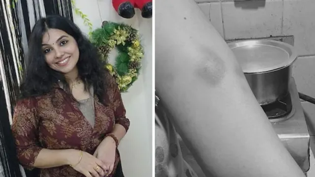 indianorigin-woman-found-dead-in-uae-on-her-30th-birthday-family-accuses-husband-of-abuse-fir-filed-in-kerala