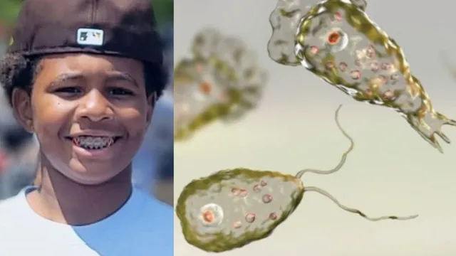 12-year-old-dies-from-brain-eating-amoeba-infection-in-south-carolina
