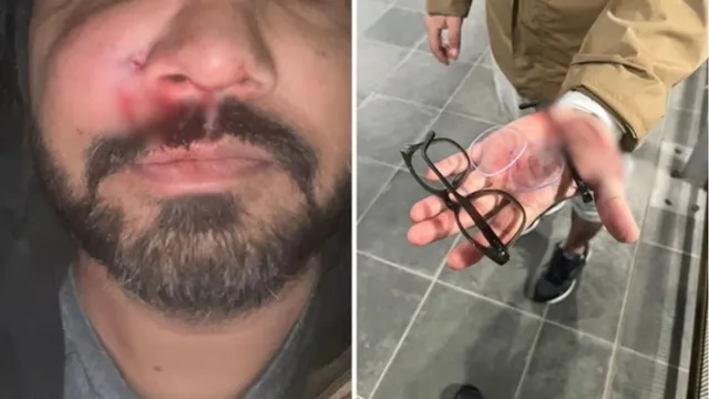 indian-origin-man-brutally-attacked-in-ireland-suffers-fractured-cheekbone-they-left-me-bleeding