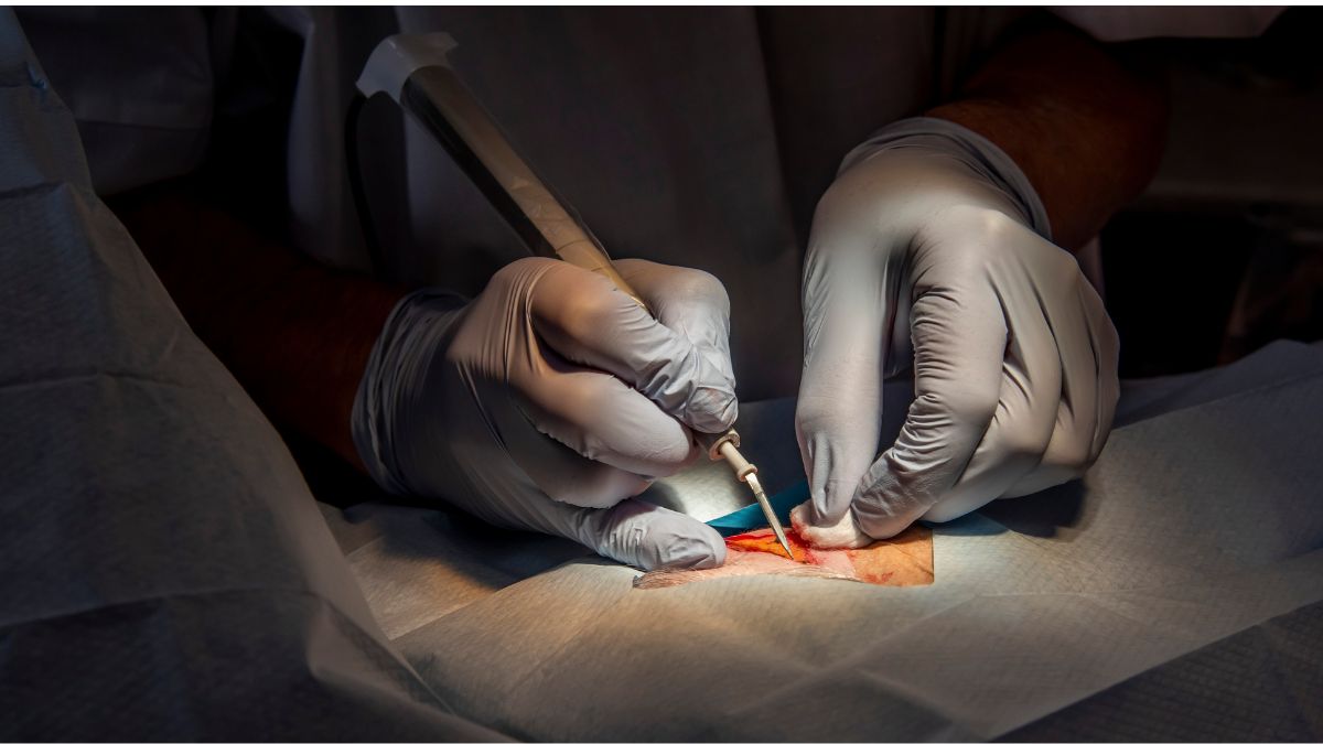 Cancer Surgery (1)