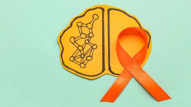 how-multiple-sclerosis-impact-lives-doctor-shares-invisible-symptoms-and-daily-challenges