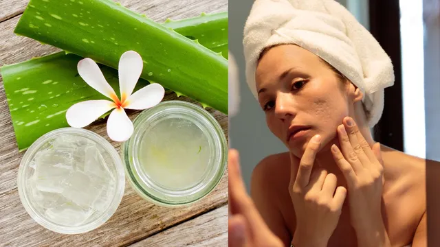 how-to-fade-face-scars-naturally-at-home-5-home-remedies-to-try