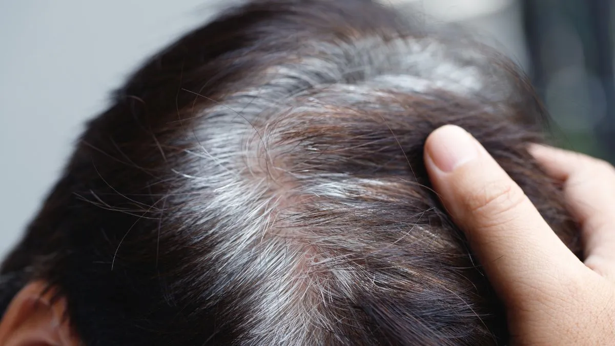 7-melanin-rich-foods-you-should-eat-to-stop-premature-hair-greying