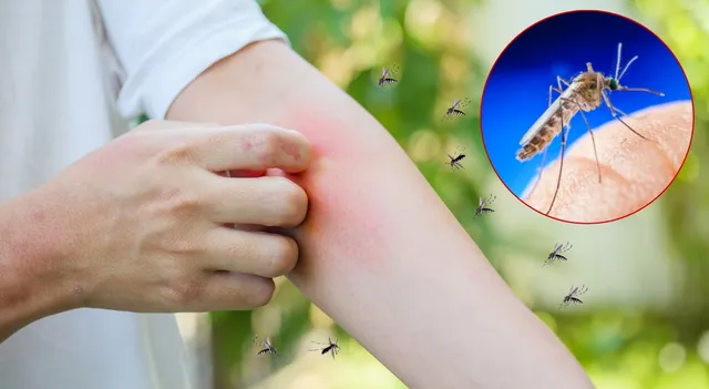 why-do-mosquitoes-bite-you-more-than-others