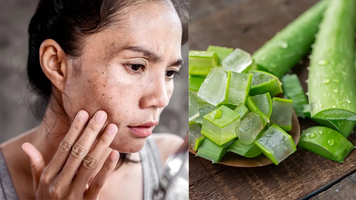 7-natural-diy-remedies-to-reduce-hyperpigmentation-on-face-at-home