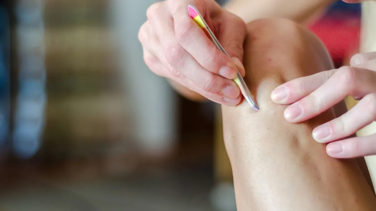 5-quick-fixes-for-ingrown-hair-relief-that-really-work