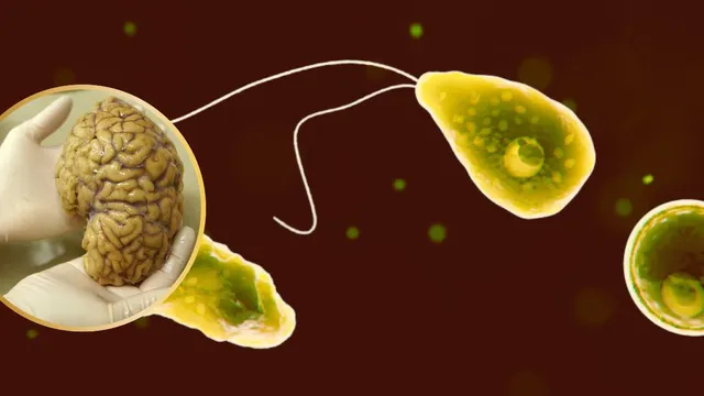 brain-eating-amoeba-detected-in-queensland-water-is-tap-water-still-safe