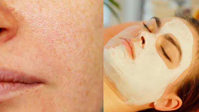 5-natural-face-packs-to-shrink-stubborn-open-pores-and-reveal-smooth-skin