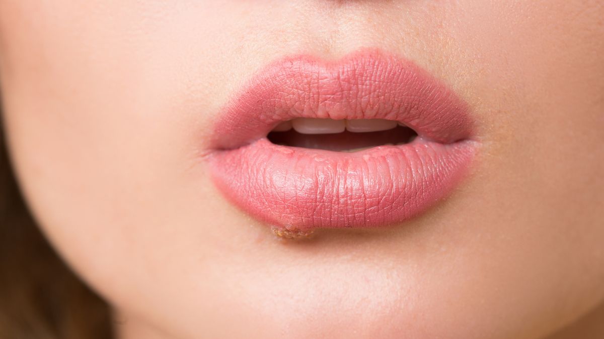 Heart Problem Lips 6 Lip Health Signs That May Signal Heart Problems