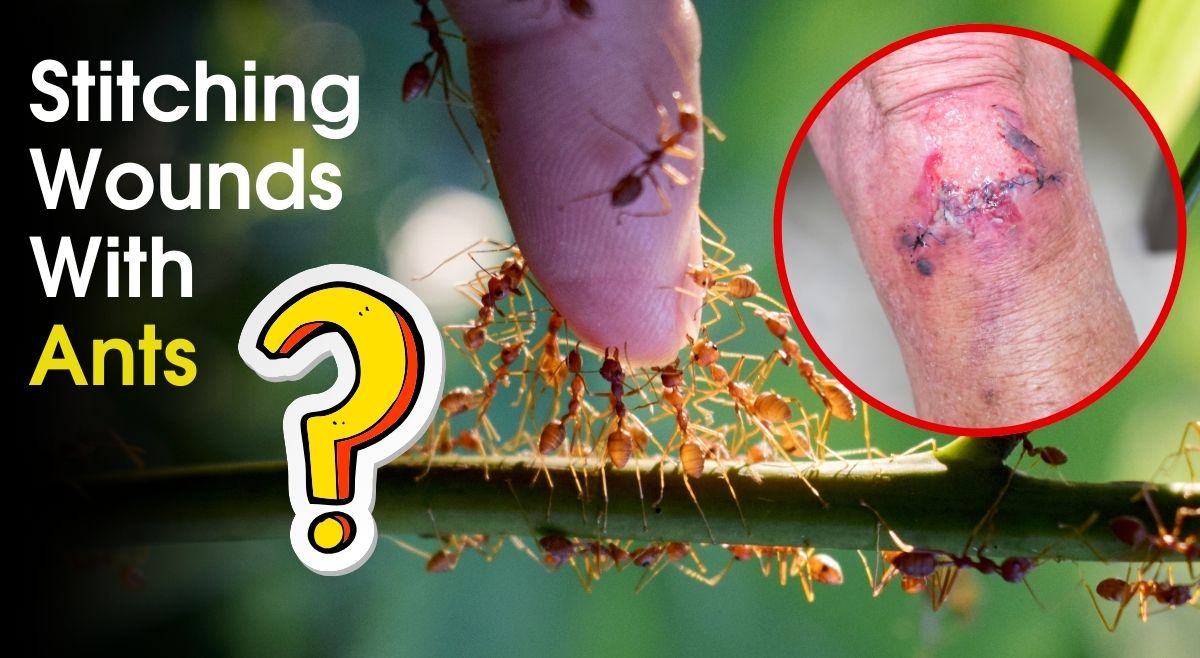 people-used-ants-to-stitch-wounds-know-how-and-why