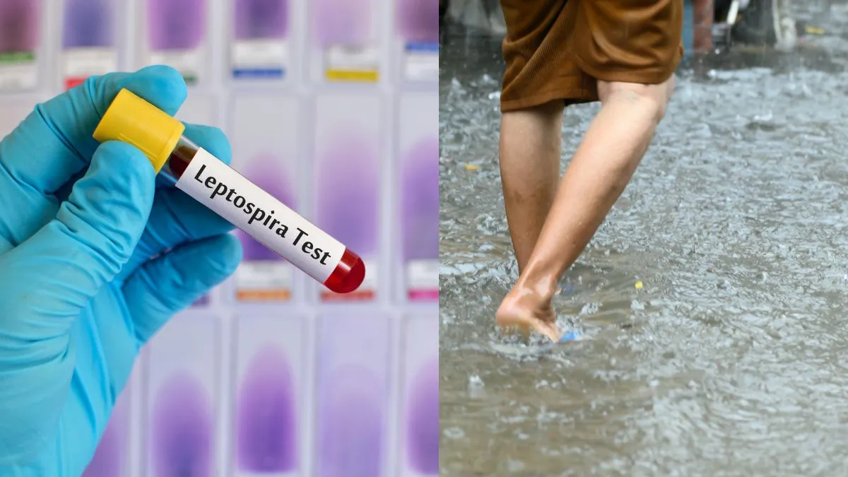 what-is-leptospirosis-doctor-shares-causes-treatment-and-prevention-of-hidden-monsoon-danger