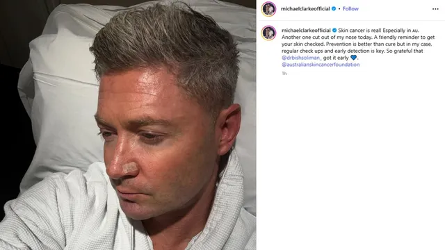 michael-clarke-australias-world-cup-winning-captain-reveals-diagnosis-with-skin-cancer