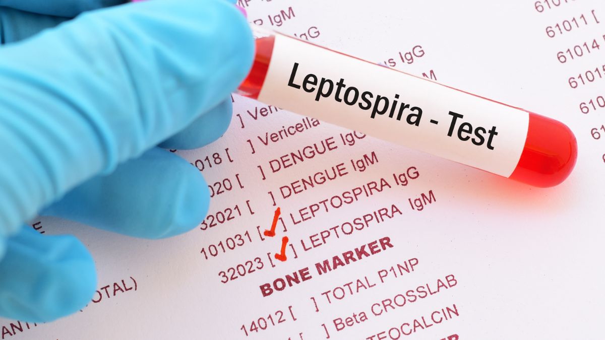 Leptospirosis Causes