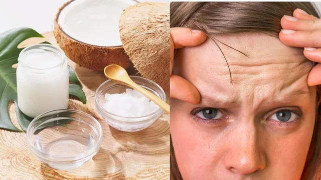 6-home-remedies-to-minimise-facial-wrinkles-and-fine-lines