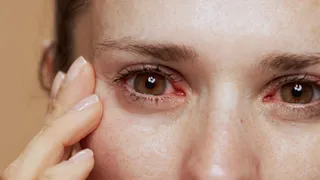 Can Tap Water Harm Your Eyes? Doctors Warn About Hidden Acanthamoeba Risk