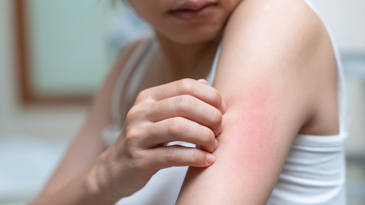 Kidney Disease Symptoms On Face And Neck (1)