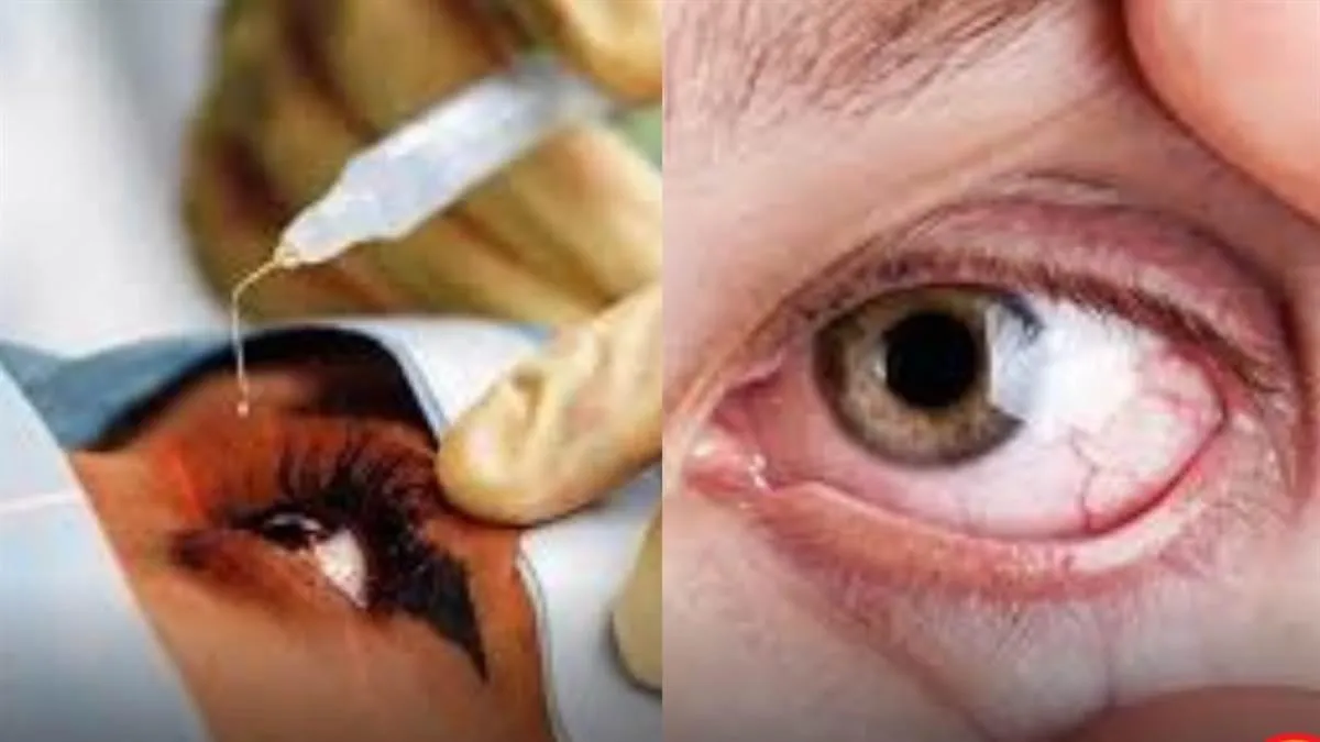 glass-shard-pierces-eye-removed-from-brain-in-35hour-surgery