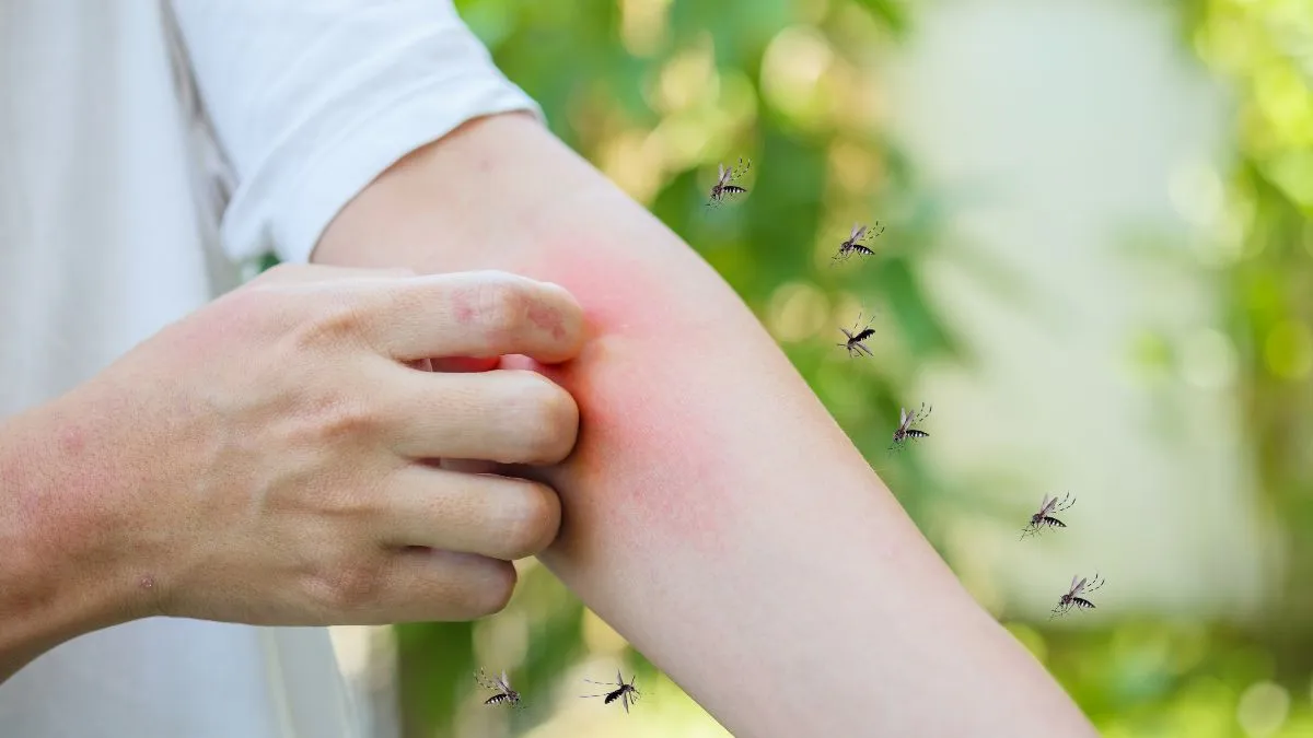 can-a-mosquito-bite-mean-more-than-just-rashes-and-allergies-doctor-explains