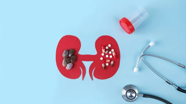 kidney-stones-on-the-rise-doctor-shares-lifestyle-changes-that-can-lower-risk
