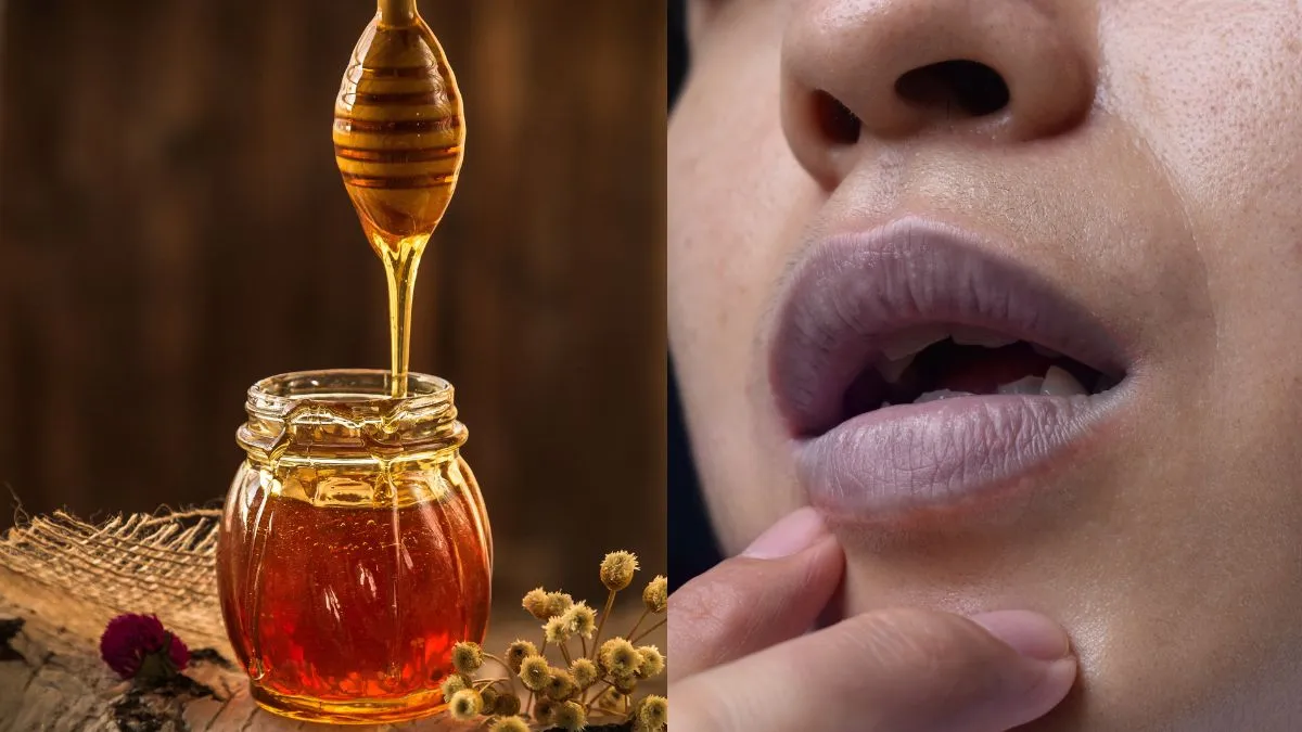 5-home-remedies-to-get-rid-of-dark-lips-naturally