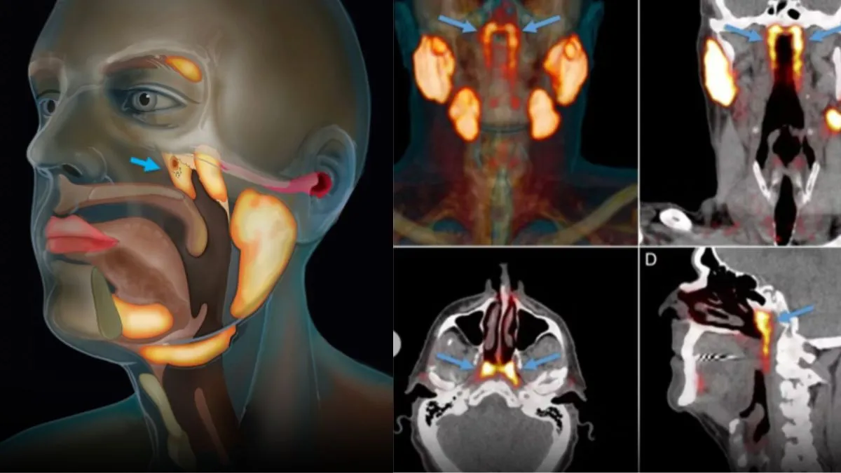 human-bodys-secret-organ-tubarial-salivary-glands-finally-uncovered-after-300-years-this-could-change-cancer-treatment-forever