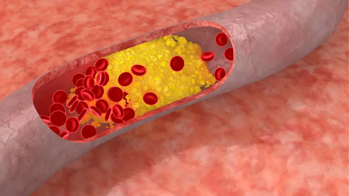 how-to-lower-bad-cholesterol-at-home-try-these-5-natural-ways