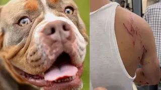 Delhi: Family Sets Pet Rottweiler Dog Loose On Neighbours After Scuffle Over Parking In Welcome, 5 Bitten
