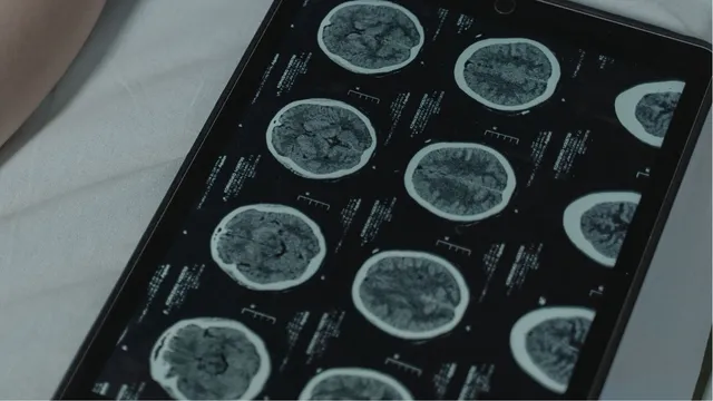 andhra-news-class-6-student-suffers-skull-fracture-after-teacher-hits-her-with-lunch-bag-hospitalised-in-bengaluru