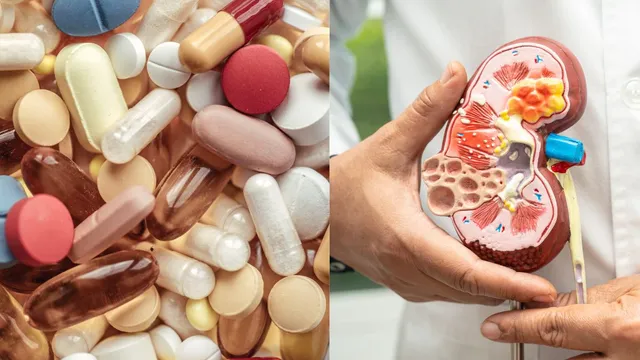 doctor-explains-how-painkiller-habits-can-cause-damage-to-your-kidneys