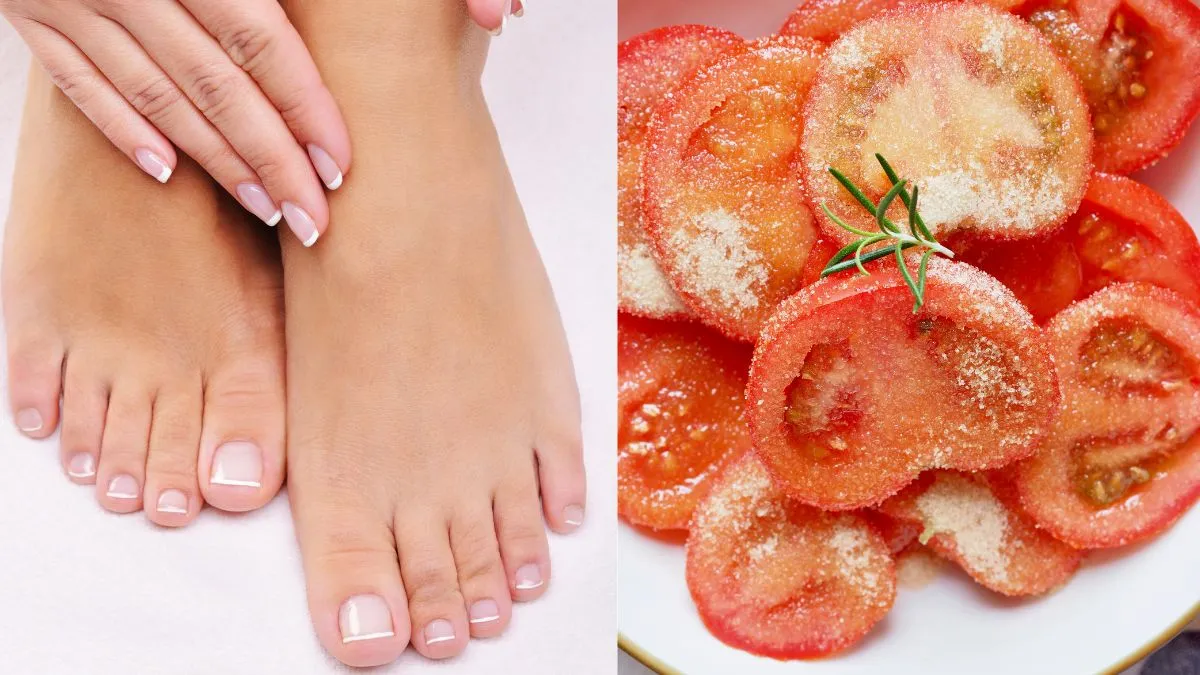 5-diy-natural-remedies-to-de-tan-your-feet-naturally-at-home