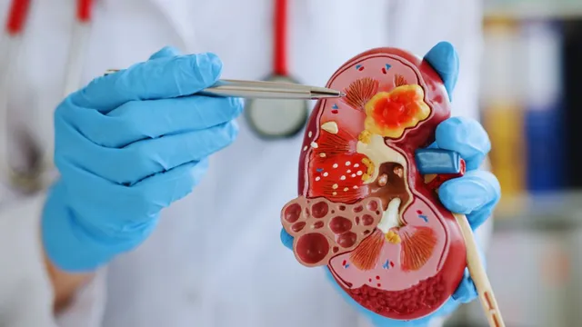 madhya-pradesh-news-health-scare-children-die-within-a-month-in-chhindwara-due-to-suspected-kidney-infections-authority-issue-advisory-for-certain-syrups