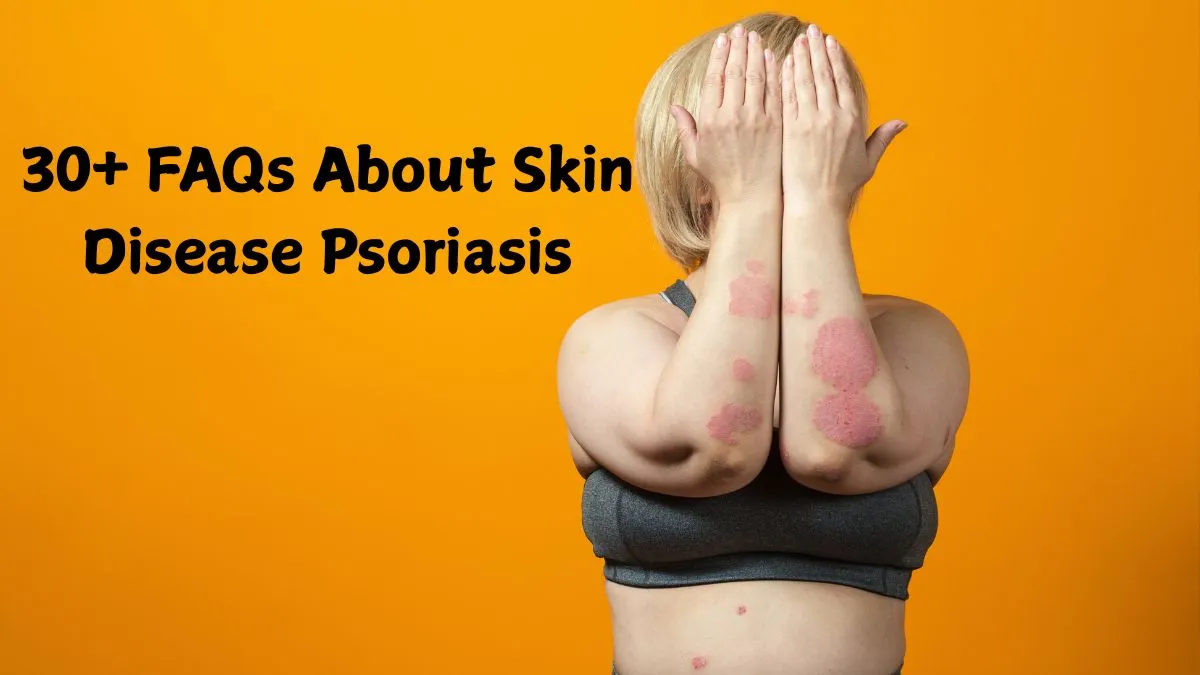 faqs-about-skin-disease-psoriasis-on-world-psoriasis-day-2025-symptoms-treatment-and-more