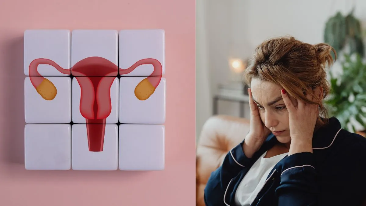 Photo inspiration: Picture Idea: Pcos And Stress Doctor Explains The Mind Body Connection That
