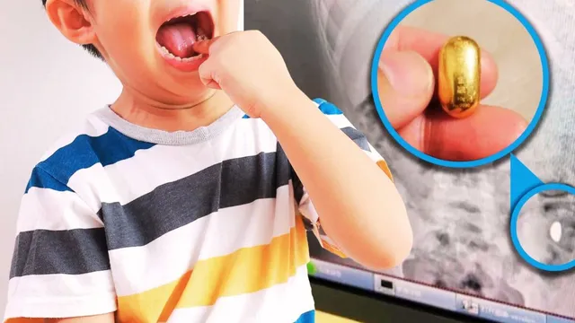 chinese-boy-swallows-gold-accidently-mom-says-dont-poop-outside-your-stool-way-too-valuable-now