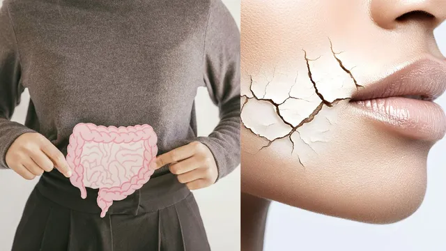 how-winter-gut-care-can-transform-your-skin-know-from-doctor