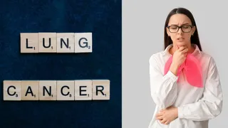 Why More Non-Smokers Are Getting Lung Cancer; Doctor Shares Hidden Causes
