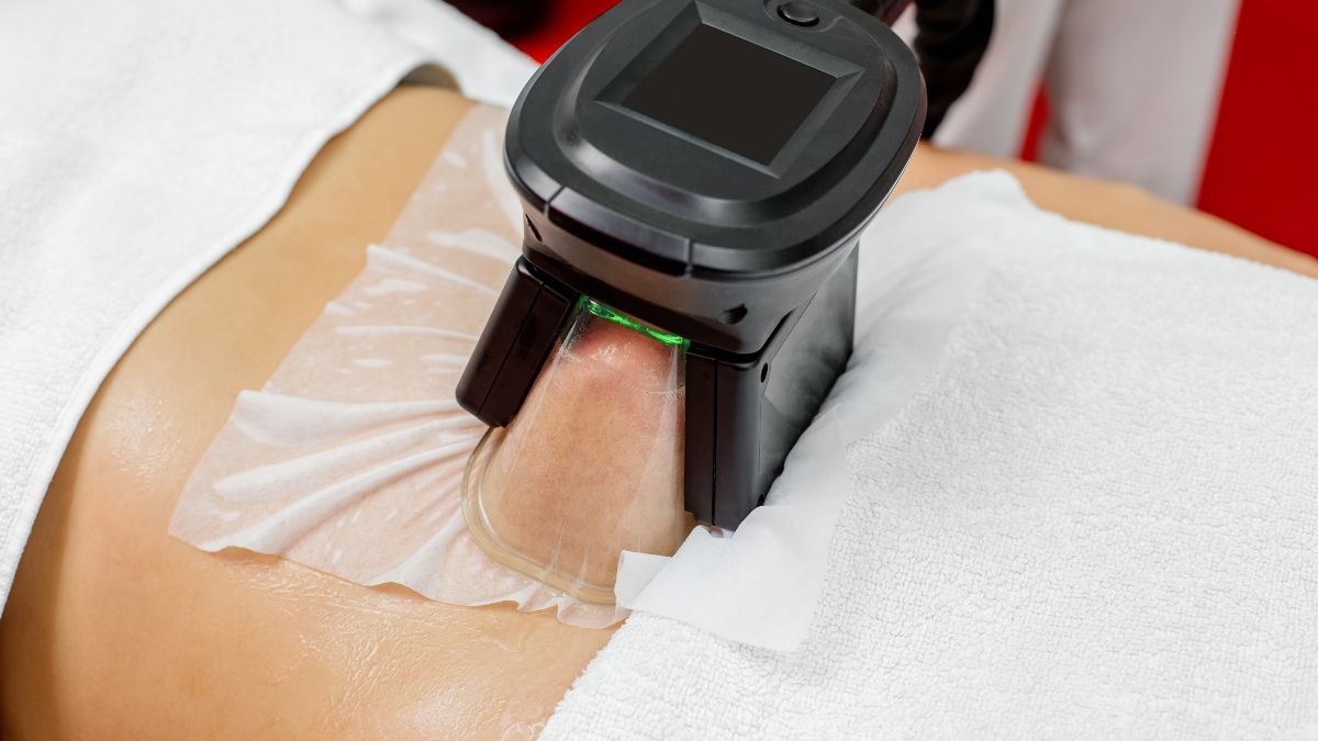 Egg Freezing Tips