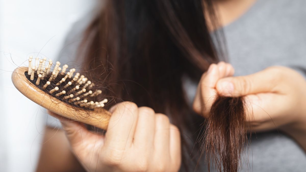 Winter Hairfall