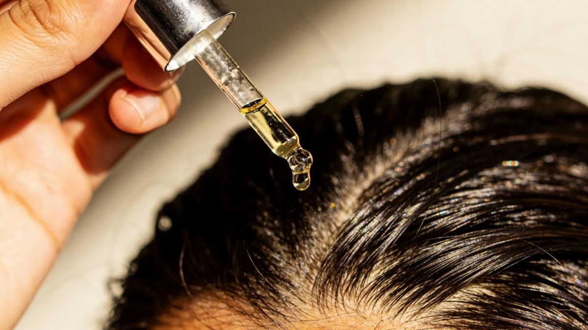 Coconut Oil vs Almond Oil For Winter Scalp