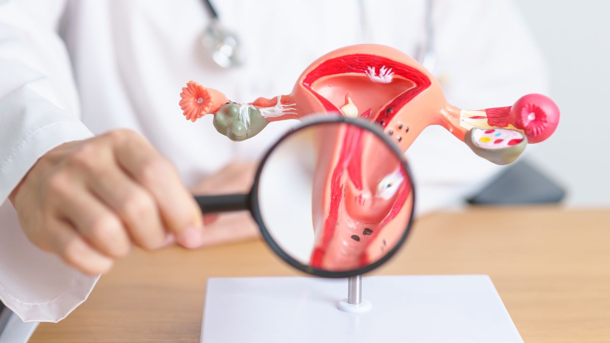Endometriosis