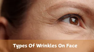 These 7 Facial Wrinkles Reveal More About Your Age Than You Think
