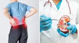Early Signs Of Kidney Disease Most People Miss: Types And Symptoms You Should Know
