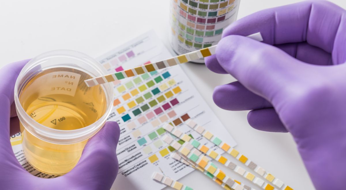 urine sample
