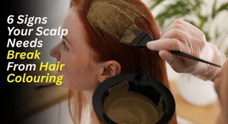 6 Clear Signs Your Scalp Needs Break From Harsh Hair Colouring