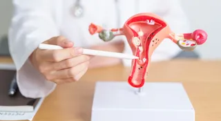 Why PCOS Is Now PMOS: What Does The New Name Suggest About Its Impact On Women
