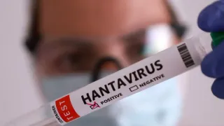 Hantavirus Panic After Cruise Outbreak? Canadian Passenger Tests Positive; What Authorities Said Next