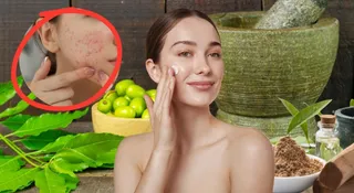 AM To PM Ayurvedic Skincare Routine: 6 Steps For Healthy And Glowing Skin During Monsoon