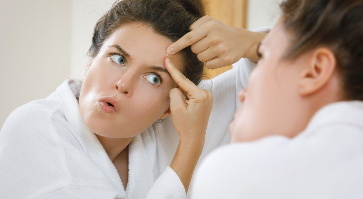 Temple Pimples